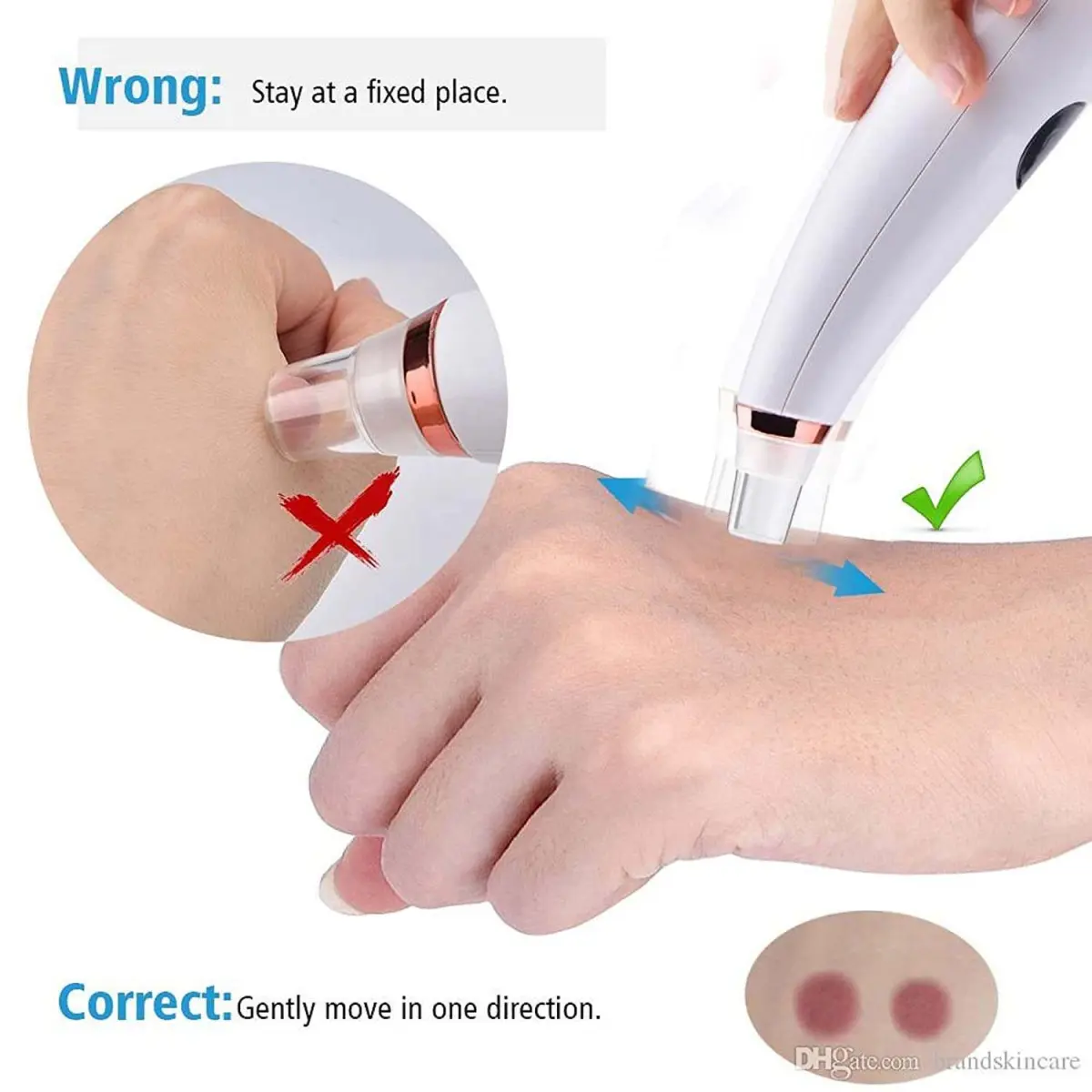 Blackhead Remover Facial Pore Vacuum Cleaner Electric Skin Care Pimple Extractor Cleaning Air Suction Machine Blackhead Remover Tool for Women and Men - Product Image 4