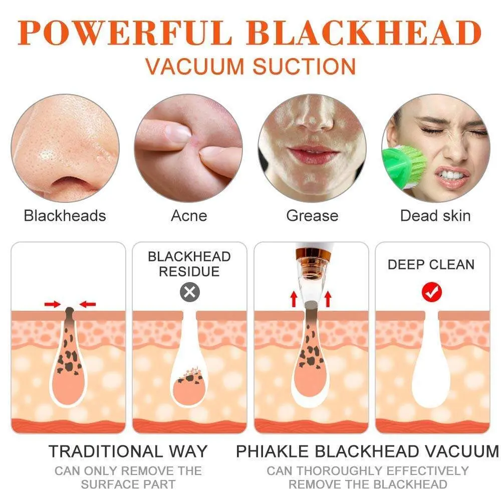 Blackhead Remover Facial Pore Vacuum Cleaner Electric Skin Care Pimple Extractor Cleaning Air Suction Machine Blackhead Remover Tool for Women and Men - Product Image 2