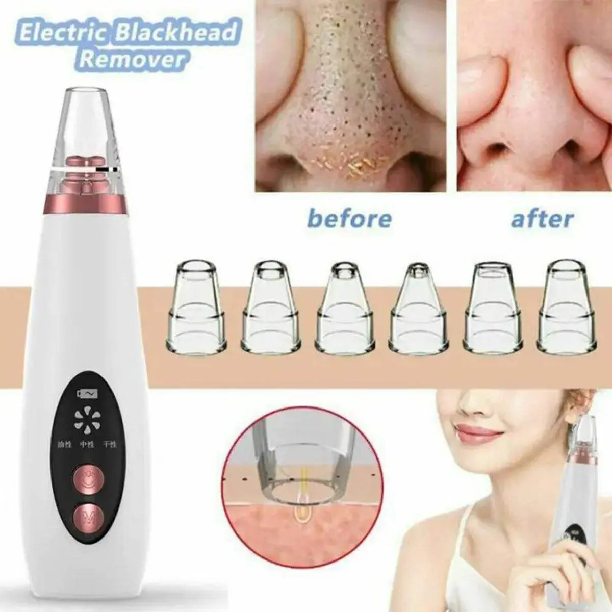 Black heads removal Rechargeable Electric Vacuum machine black head remover