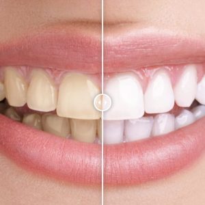 Before & After Images Comparison WordPress Plugin